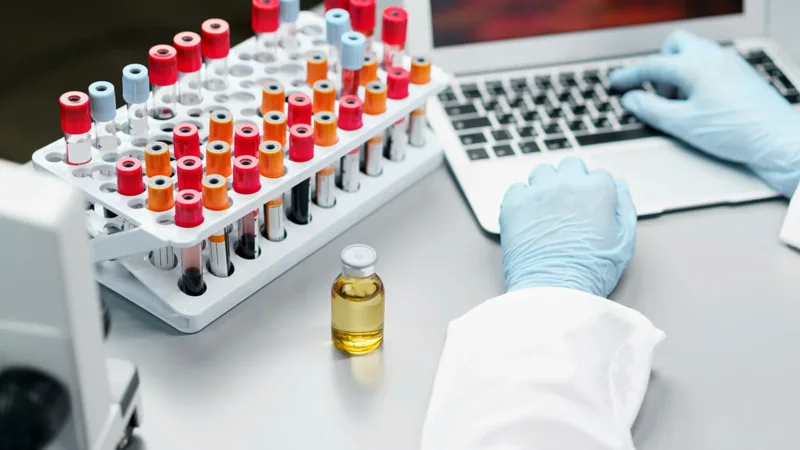Control materials and samples on a laboratory bench